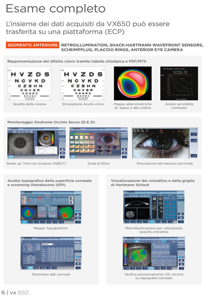Foto Ottica Farina controllo della vista spiegazione visionx
